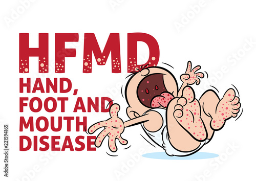 Crying baby with hand, foot and mouth disease or HFMD illustration photo