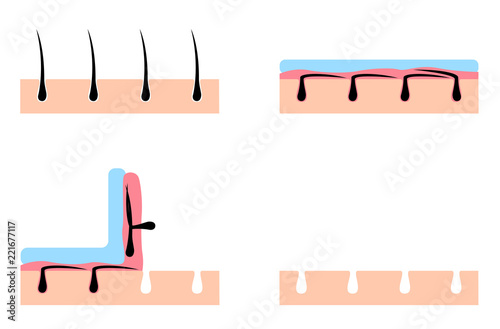 wax and waxing on human hair vector / hair removal