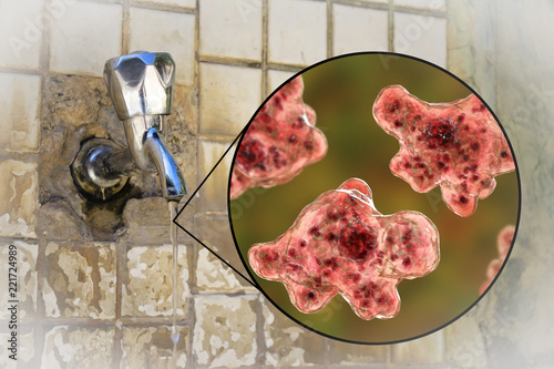 Brain-eating amoeba awareness concept. 3D illustration showing potential way of aquiring infection during ritual nasal rinsing. Trophozites of Naegleria fowleri can be present in dirty tap water photo