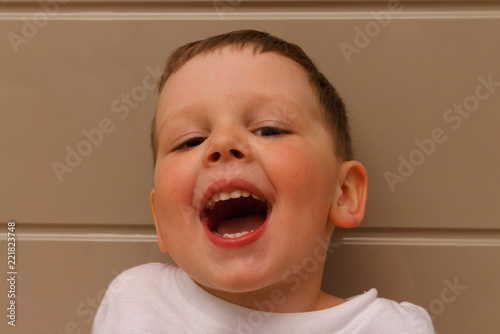 boy, child, in a white T-shirt opened his mouth on examination with a doctor. a dentist or an otolaryngologist. fix bite of teeth.curves baby teeth in the child, oral care. photo