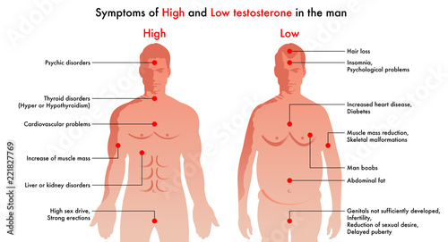 medical illustration of the symptoms and consequences in man to have a high level or a low level of testosterone photo