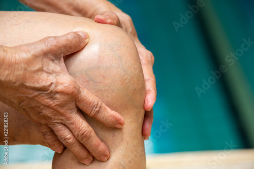 Senior woman suffering from knee pain, Massaging by her hand, Blue swimming pool background