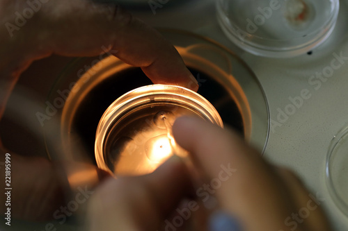 Принти на полотні This images shows the process of IVF