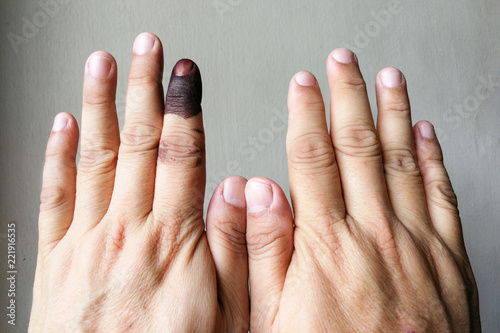 Index finger with indelible ink stain after voting in election photo