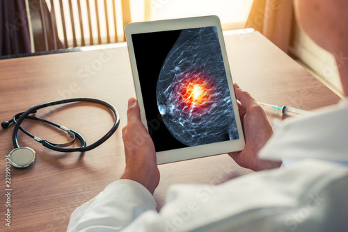 Doctor holding a digital tablet with xray mammogram skeleton. Breast cancer prevention