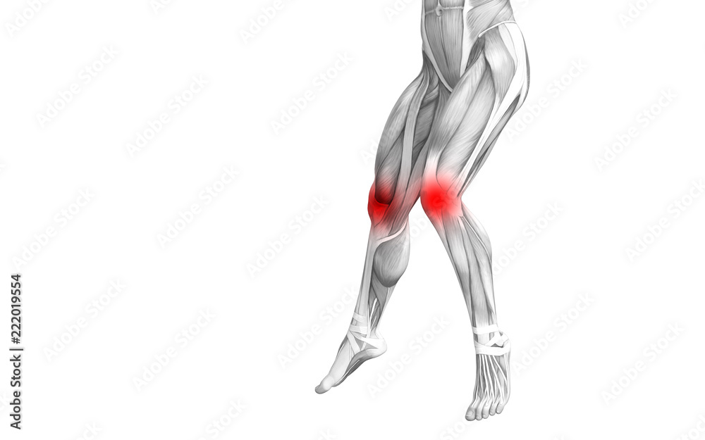 Conceptual knee human anatomy with red hot spot inflammation or articular joint pain for leg health care therapy or sport muscle concepts. 3D illustration man arthritis or bone osteoporosis disease Conceptual knee human anatomy with red hot spot inflammation or articular joint pain for leg health care therapy or sport muscle concepts. 3D illustration man arthritis or bone osteoporosis disease