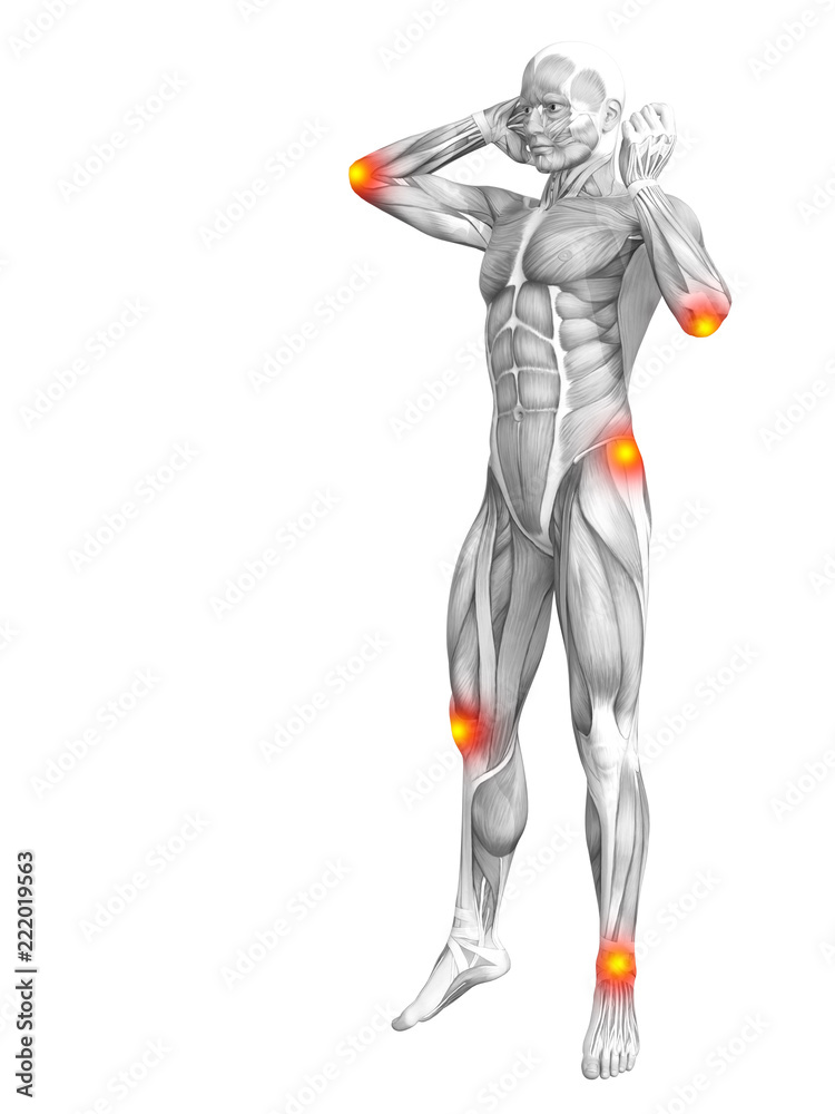 Conceptual human muscle anatomy with red and yellow hot spot inflammation or articular joint pain for health care therapy or sport concepts. 3D illustration man arthritis or bone osteoporosis disease Conceptual human muscle anatomy with red and yellow hot spot inflammation or articular joint pain for health care therapy or sport concepts. 3D illustration man arthritis or bone osteoporosis disease
