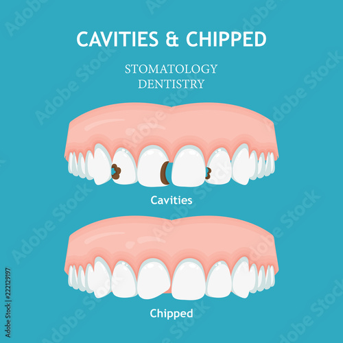 Dental concept. Dentistry and stomatology poster. Cavities and chipped