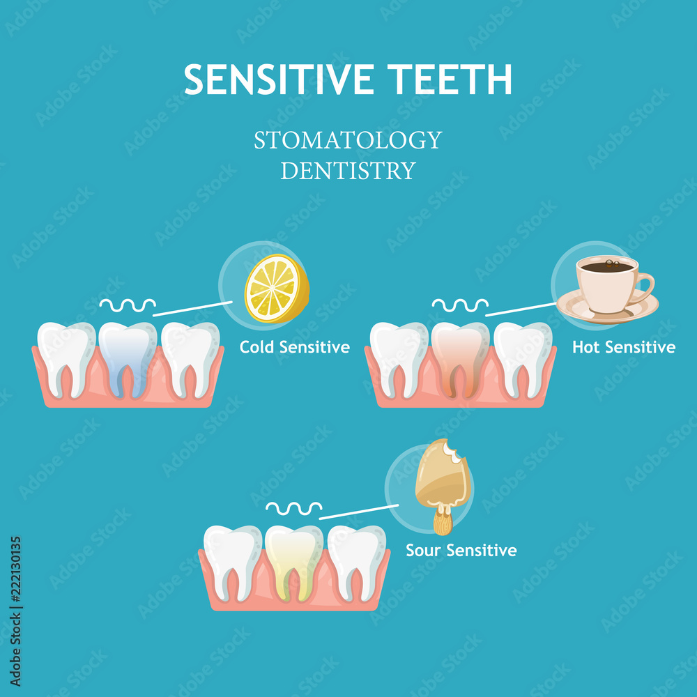 Sensitive teeth. Stomatology dentistry vector concept Stock Vector