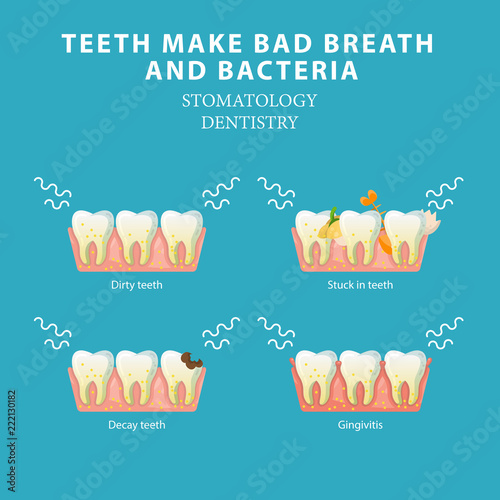 Bad breath and bacteria. Stomatology dentistry vector concept
