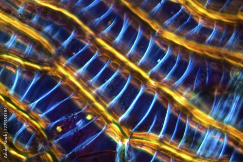 Tableau sur toile Abstract micrograph of linear cells in a peat moss leaf.