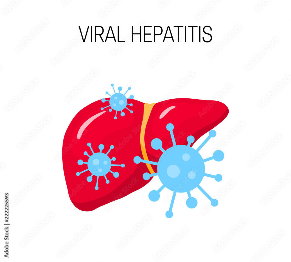Viral hepatitis vector concept - obrazy, fototapety, plakaty 