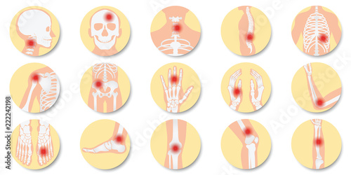 Disease of the joints and bones icon set on white background