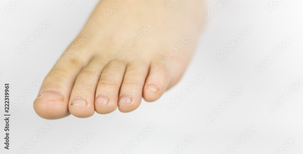 Dirty feet of a little boy's feet. Dirt under the fingernails. On a white background. Dirty feet of a little boy's feet. Dirt under the fingernails. On a white background.