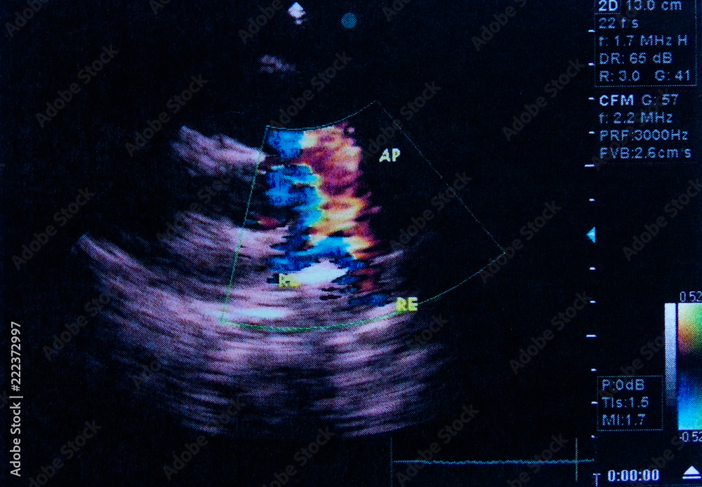 Color image of the ultrasound examination result. Made in an Ultrasound ...