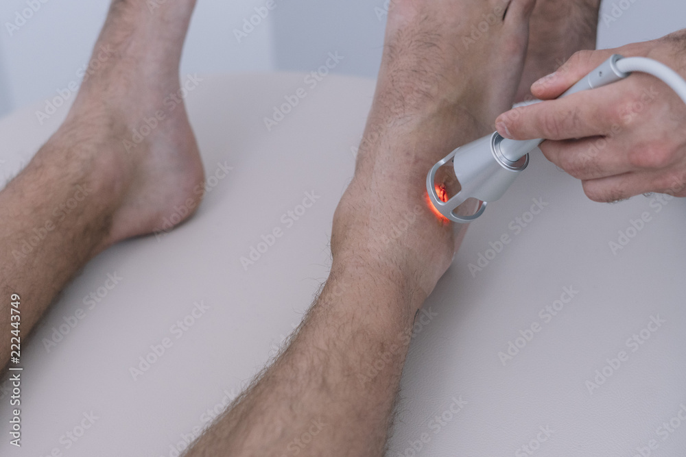 Fototapeta premium The physiotherapist treating a man using equipment for Lightning Laser