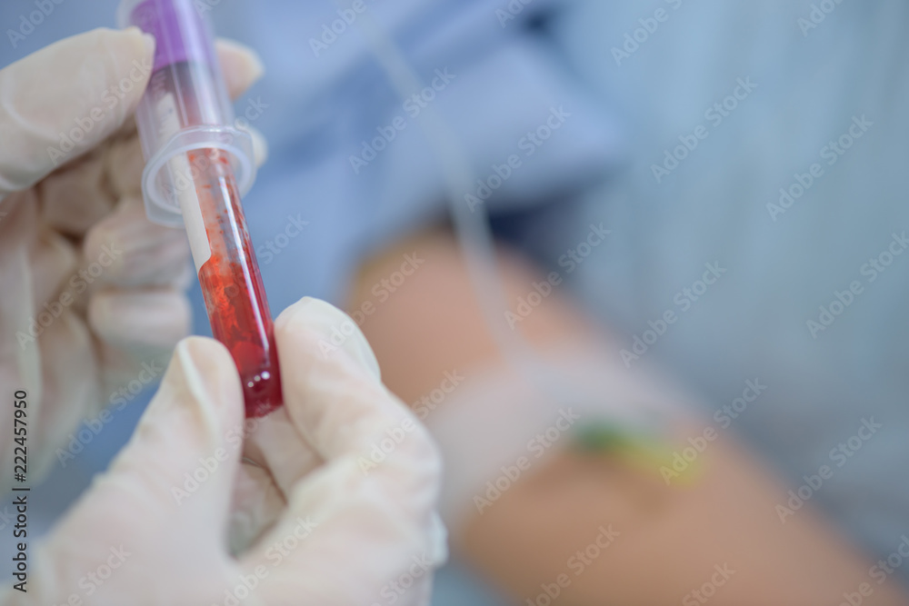 Close up of vial of blood Close up of vial of blood