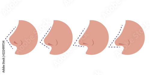 Vector illustration different types female noses