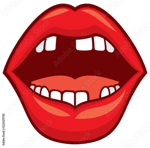 broken or lost teeth vector illustration