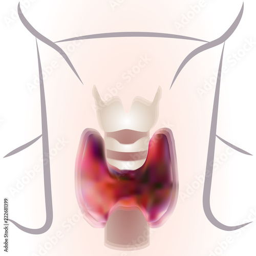 vector illustration of diagram of thyroid gland. EPS 10