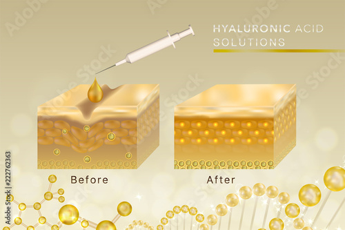 Hyaluronic acid skin solutions ad, gold collagen serum drop with cosmetic advertising background ready to use, syringe in 3d illustration.