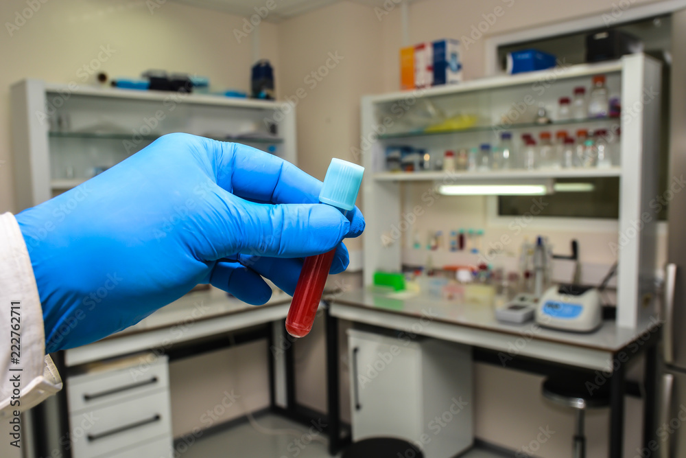 Blood testing in the laboratory.