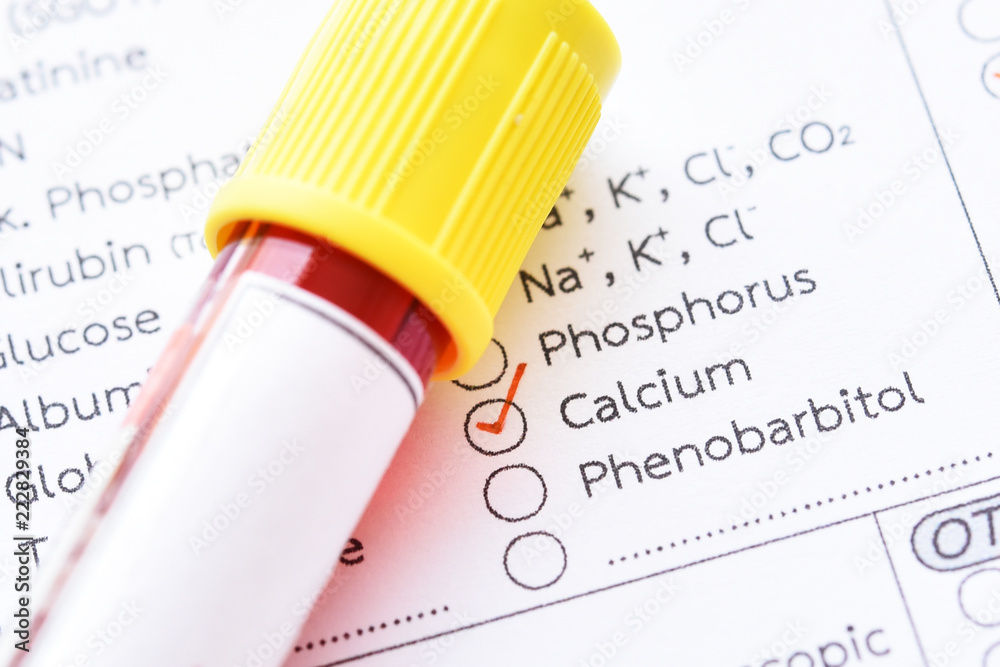 Blood sample tube with laboratory requisition form for total calcium