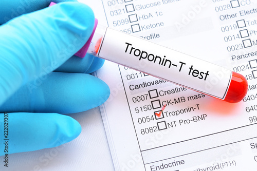 Blood sample tube for Troponin-T test, diagnosis for acute myocardial infarction (AMI)