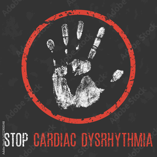 Conceptual vector illustration. The medical diagnosis. Stop cardiac dysrhythmia photo