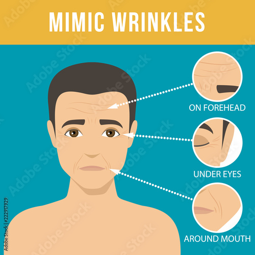 Man anti-aging skin care and men cosmetics. Different types of facial wrinkles, mimic wrinkles. Age-related skin changes. Vector