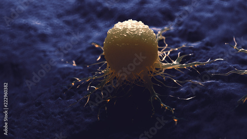 Schilderij op canvas 3d rendered medically accurate illustration of a cancer cell