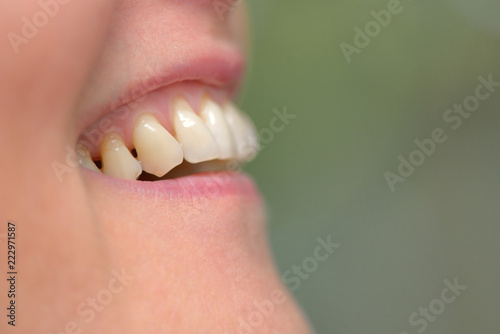 Obraz na płótnie Woman teeth parodontose w salonie
