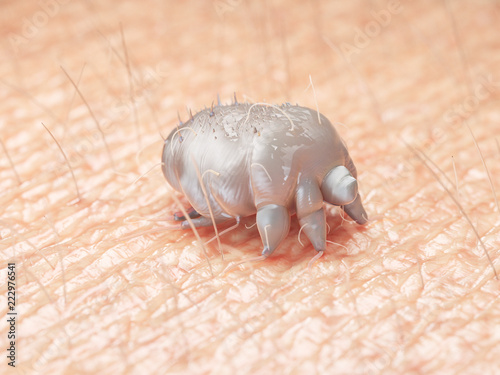 3d rendered medically accurate illustration of a scabies mite on human skin photo