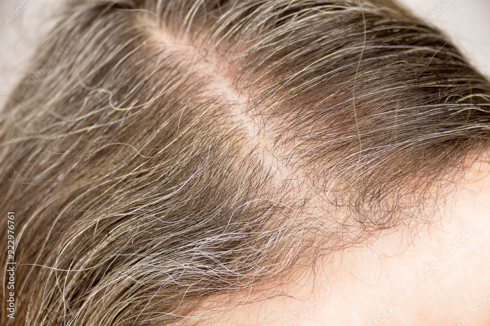 gray hair gray hair