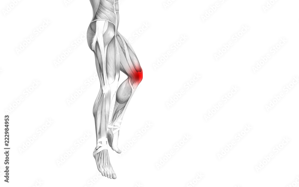 Conceptual knee human anatomy with red hot spot inflammation or articular joint pain for leg health care therapy or sport muscle concepts. 3D illustration man arthritis or bone osteoporosis disease Conceptual knee human anatomy with red hot spot inflammation or articular joint pain for leg health care therapy or sport muscle concepts. 3D illustration man arthritis or bone osteoporosis disease