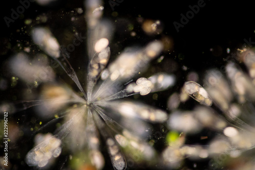 Rotifer under the microscope.