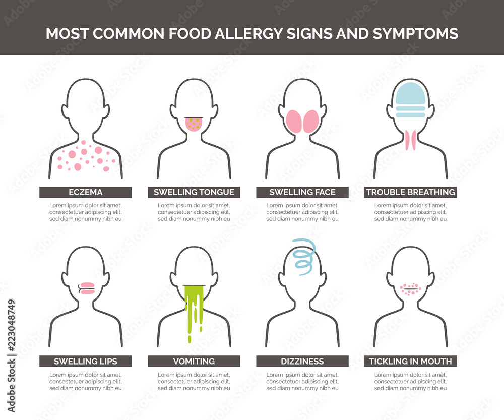 Most common food allergy signs and symptoms icon set. Vector