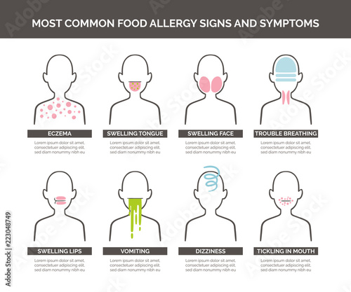 Most common food allergy signs and symptoms icon set. Vector illustration.