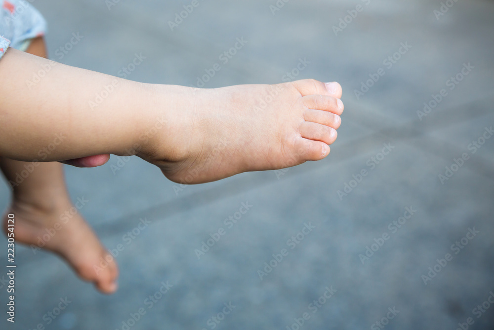 child leg and feet with blur road background. image for bacakground, wallpaper, printing, article and copy space.disease of baby ,bare foot. child leg and feet with blur road background. image for bacakground, wallpaper, printing, article and copy space.disease of baby ,bare foot.