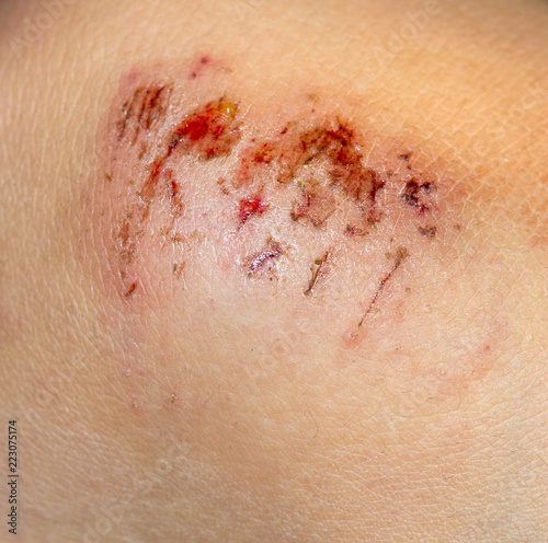 Wound on the skin of a macro