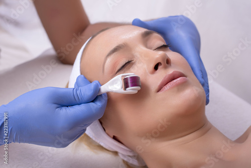 Beautiful woman during skin treatment procedure with derma roller 
