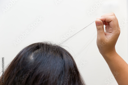 Hair pulling disorder or Trichotillomania in teenager women mental health problem. photo
