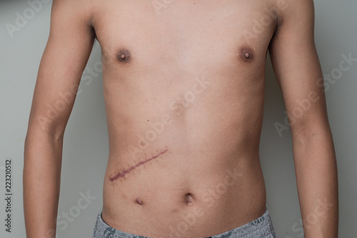 Scar cicatrix pain on human skin