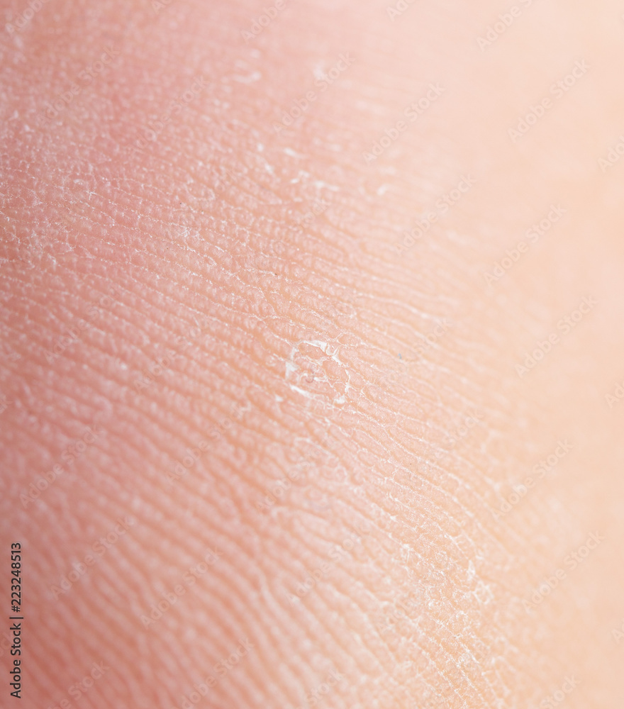Fototapeta premium Background of human skin macro