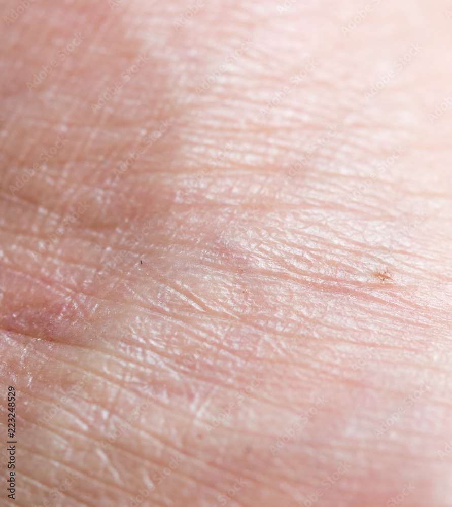 Background of human skin macro Background of human skin macro
