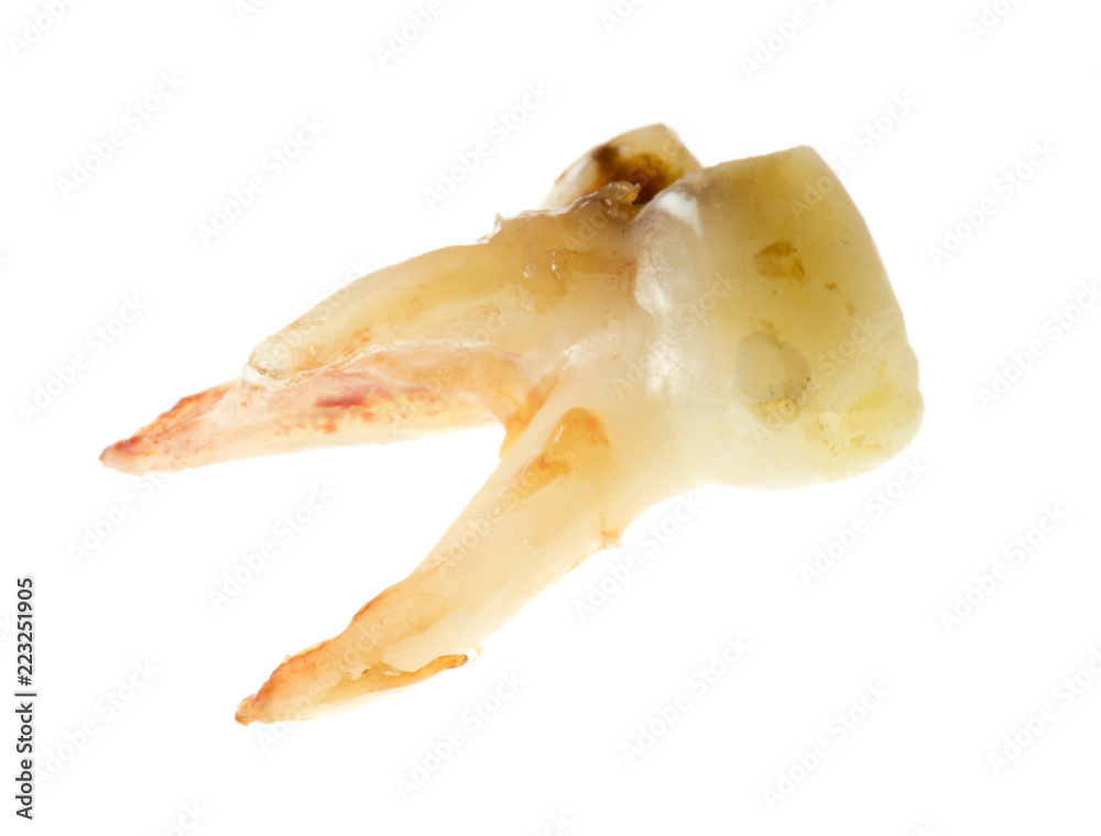 Fototapeta premium children's tooth on a white background