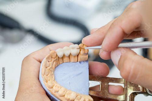 dental technician works by brush with jaw model photo