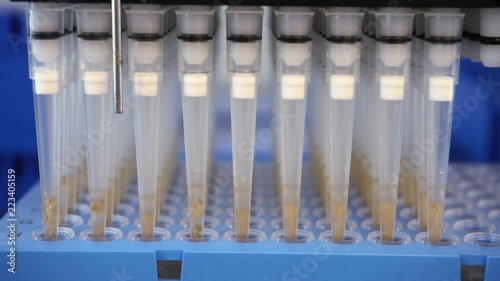 Automatic analysis of DNA. Automation in the clinical laboratory. Pipetting robot laboratory. Medicine robotics. NGS DNA diagnostics. Research and science background
