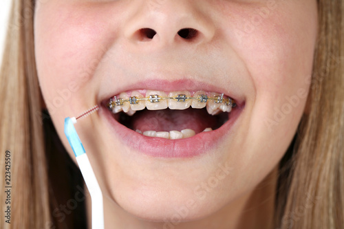 Young girl with braces and toothbrush