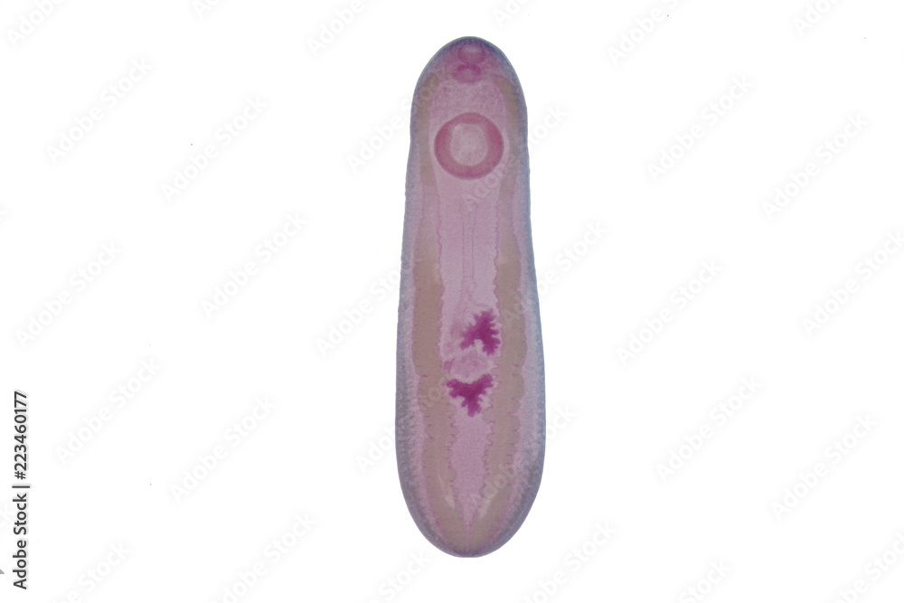 Liver fluke(Parasitic flatworm) of cattle and other grazing animals.